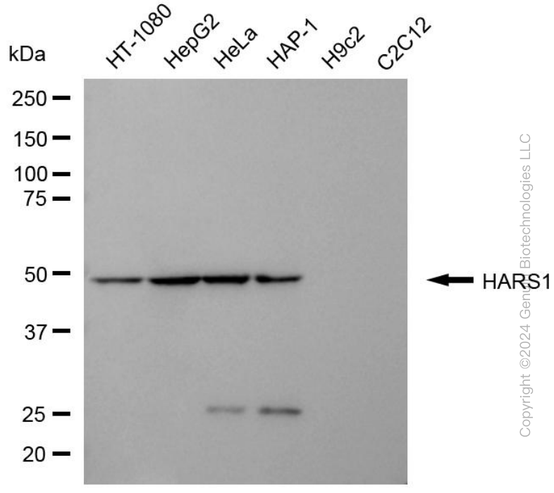 HARS1 antibody
