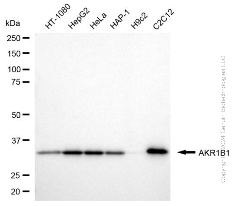 AKR1B1 antibody