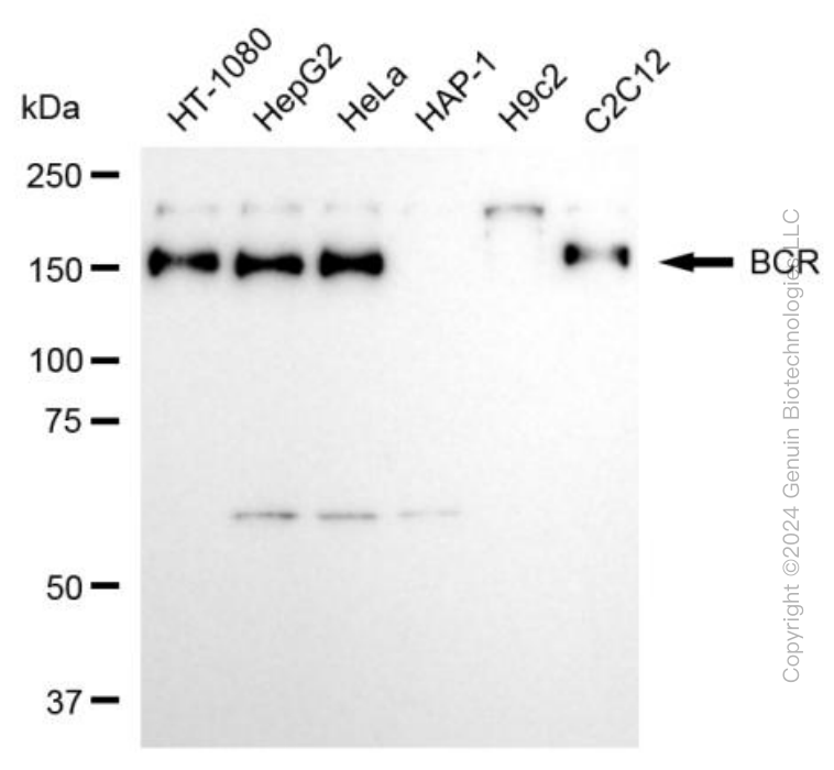 BCR antibody
