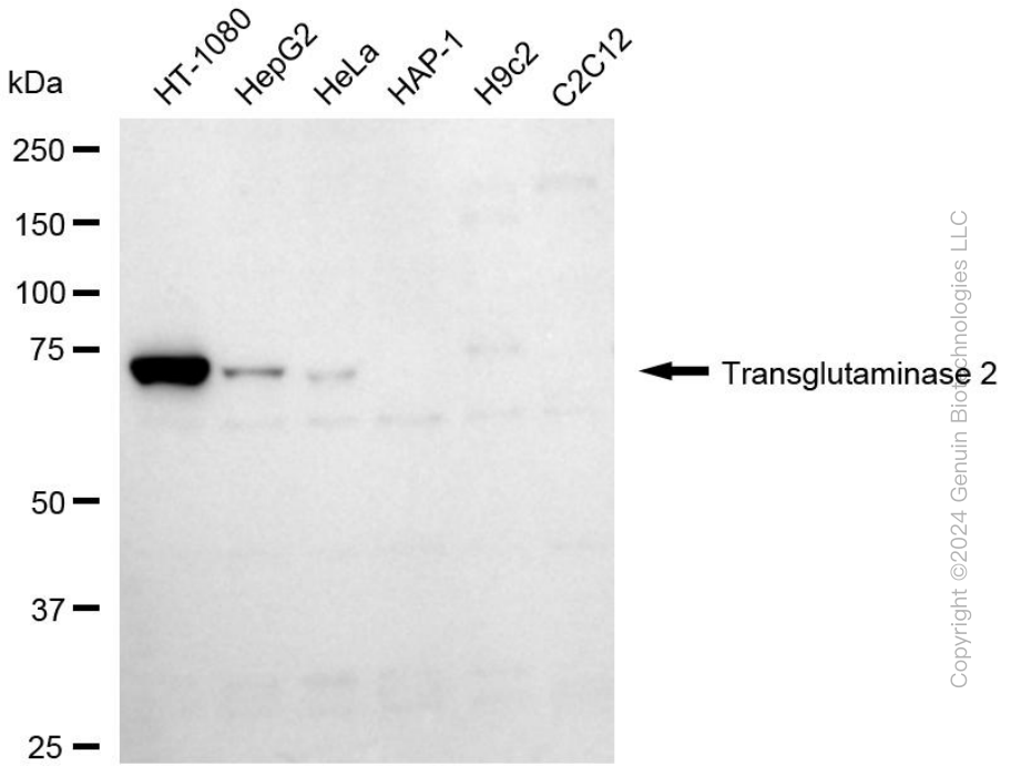 TGM2 antibody