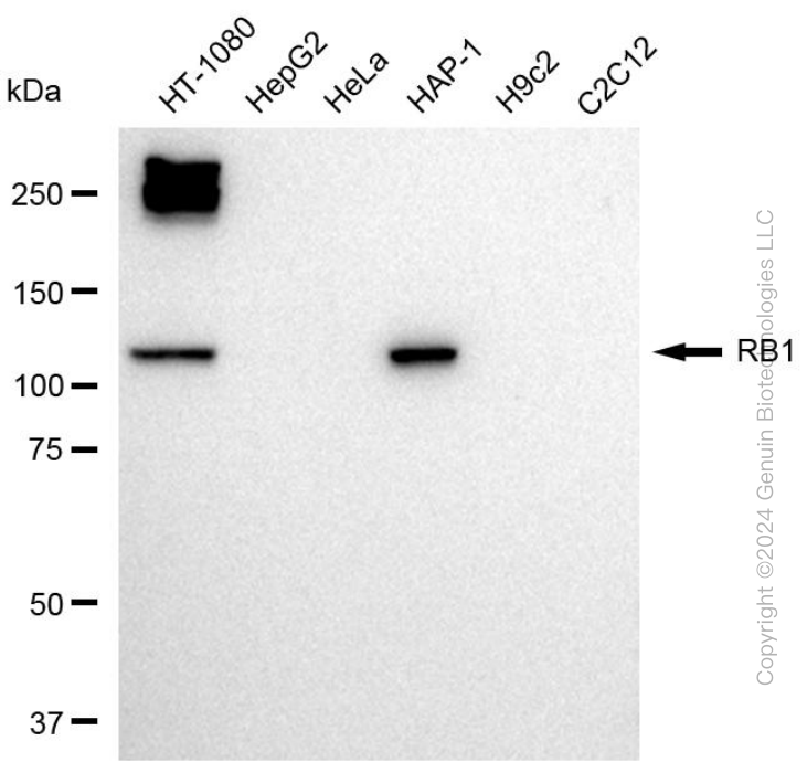 RB1 antibody