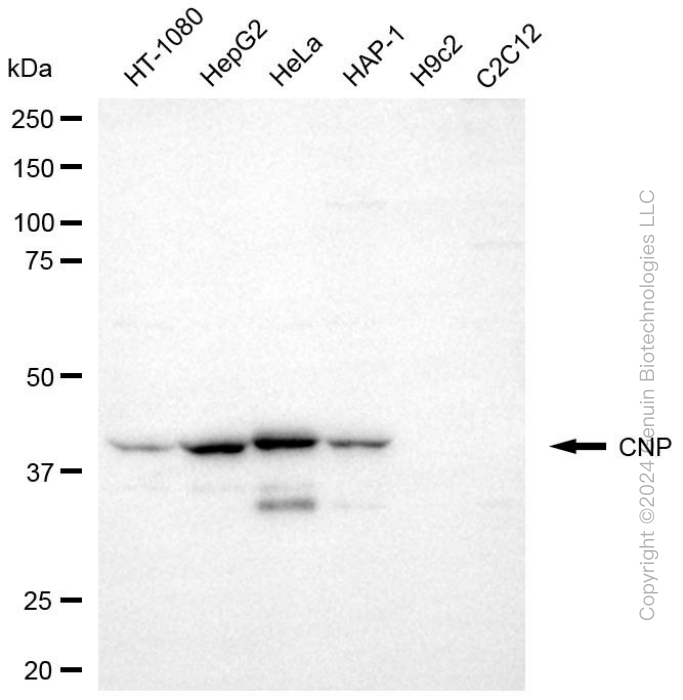 CNP antibody