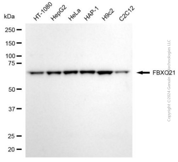 FBXO21 antibody