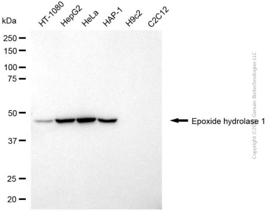 EPHX1 antibody