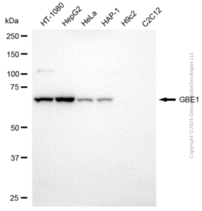 GBE1 antibody