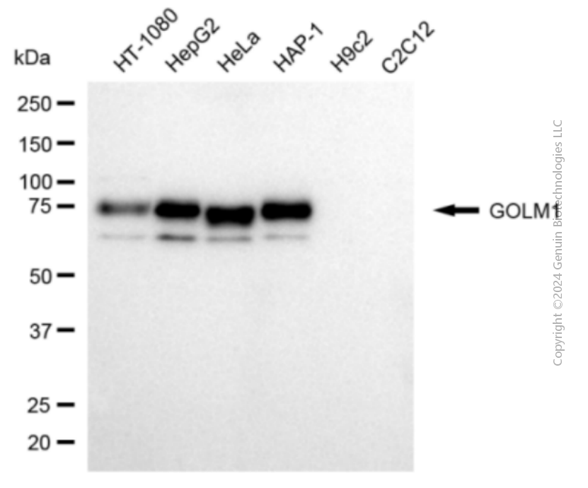 GOLM1 antibody
