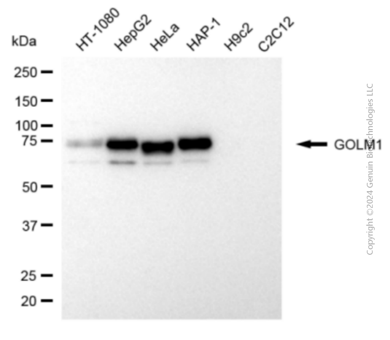 GOLM1 antibody