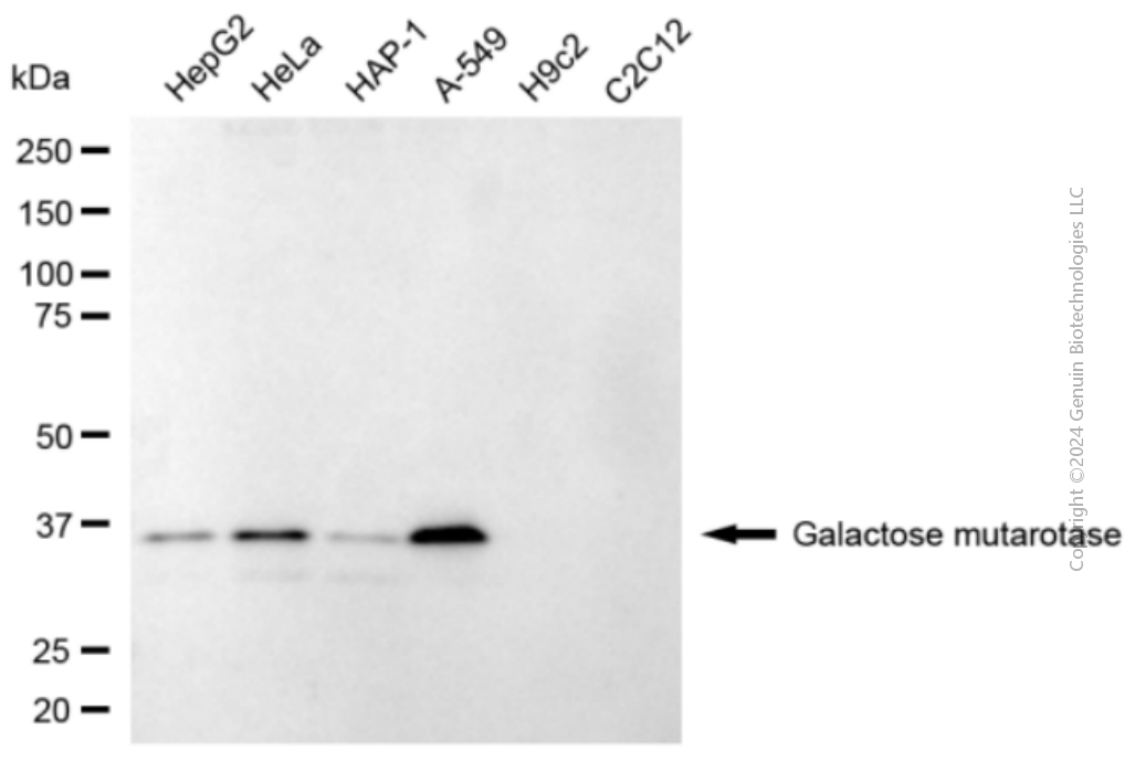 GALM antibody