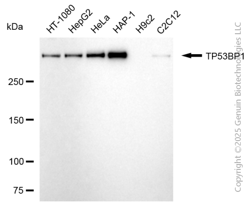 TP53BP1 antibody
