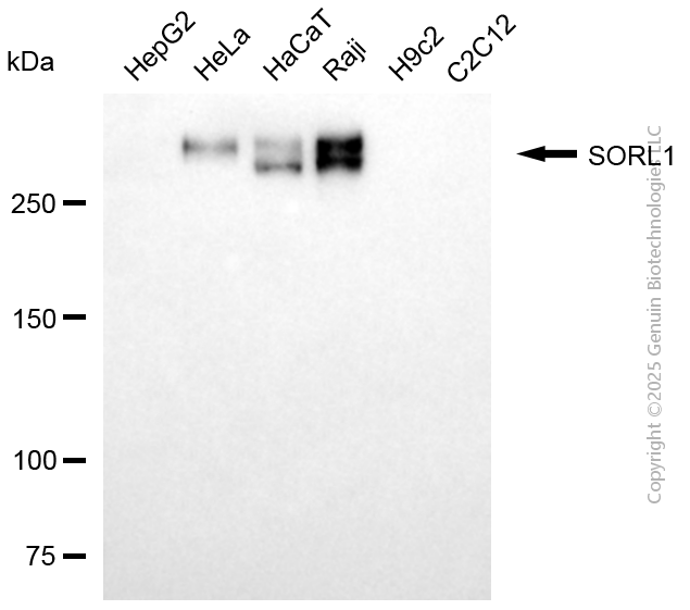 SORL1 antibody