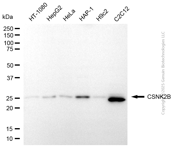 CSNK2B antibody