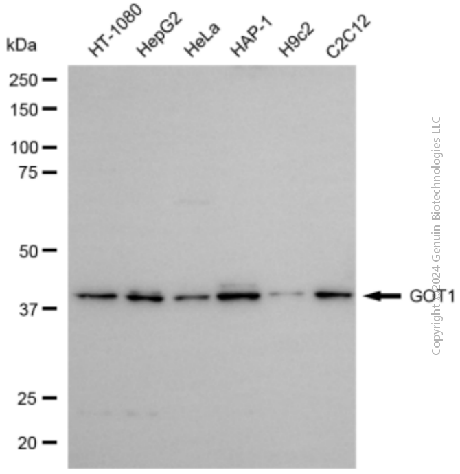 GOT1 antibody