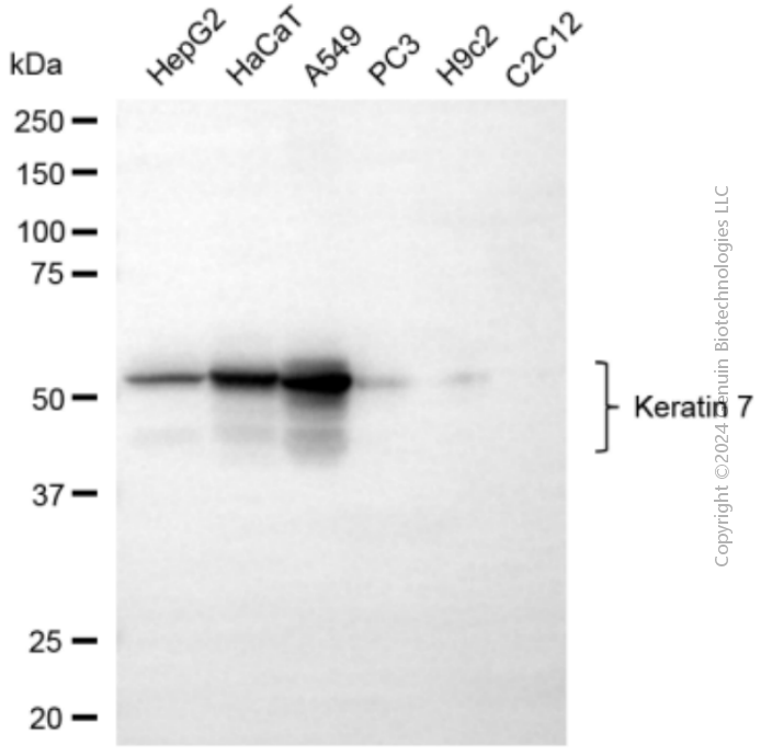 KRT7 antibody