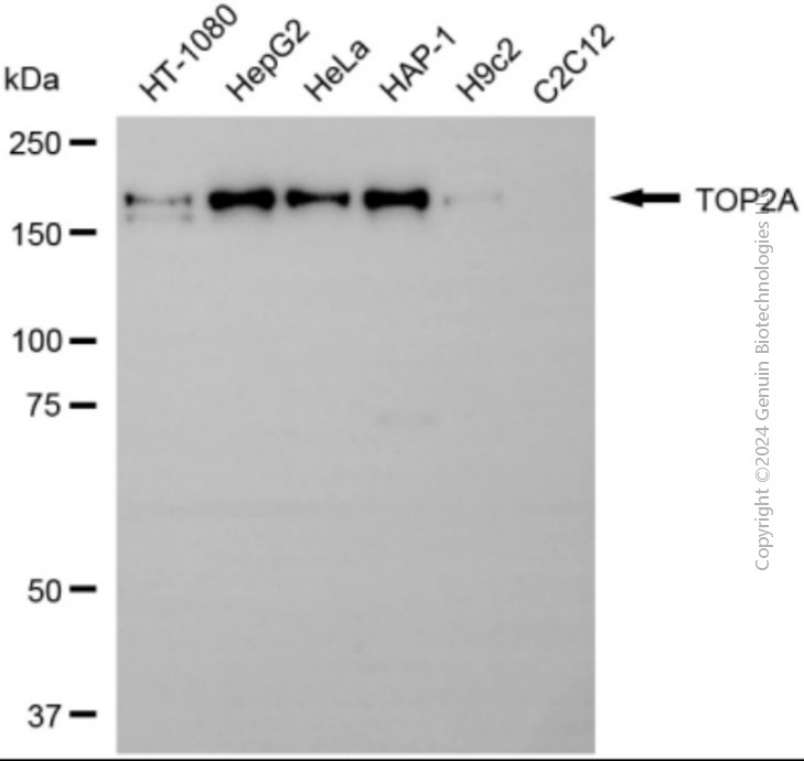 TOP2A antibody