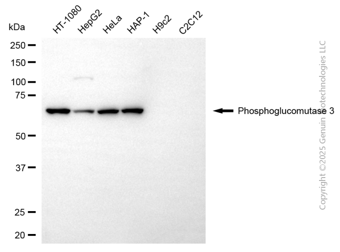 PGM3 antibody