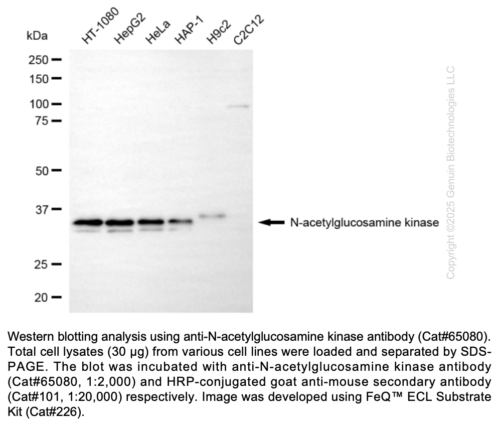 NAGK antibody