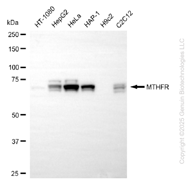 MTHFR antibody
