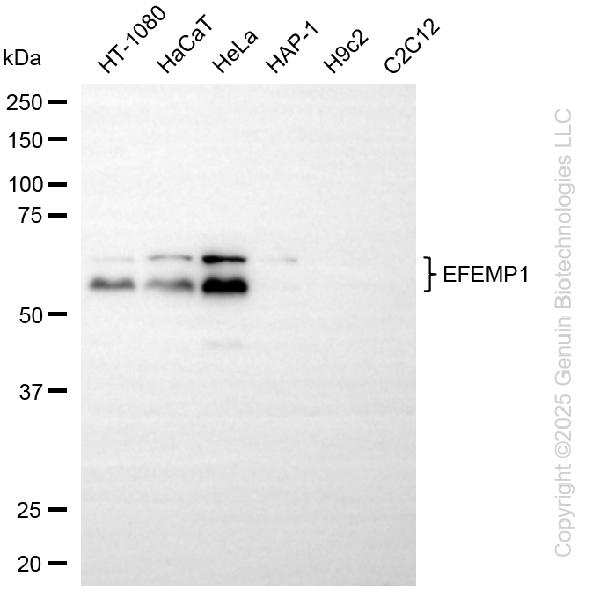EFEMP1 antibody