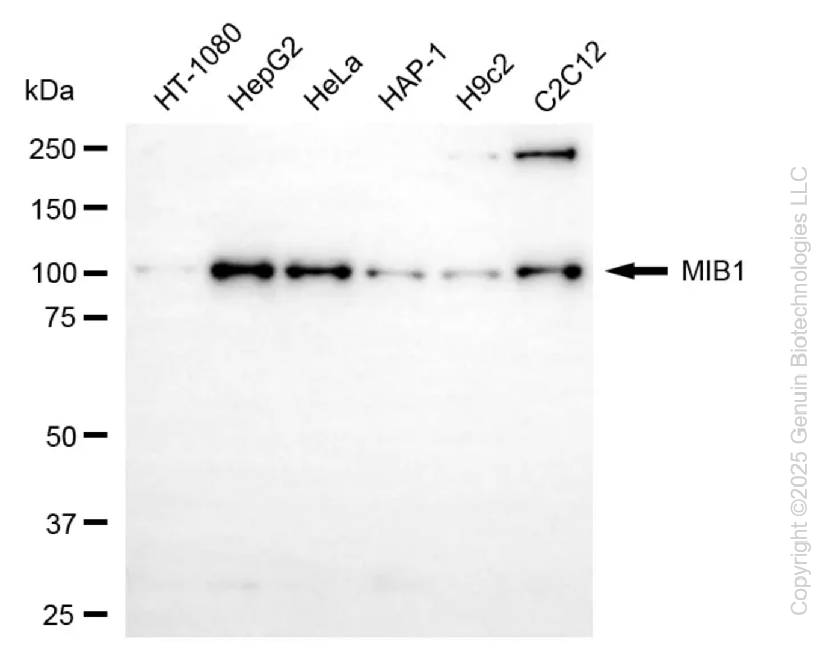 MIB1 antibody