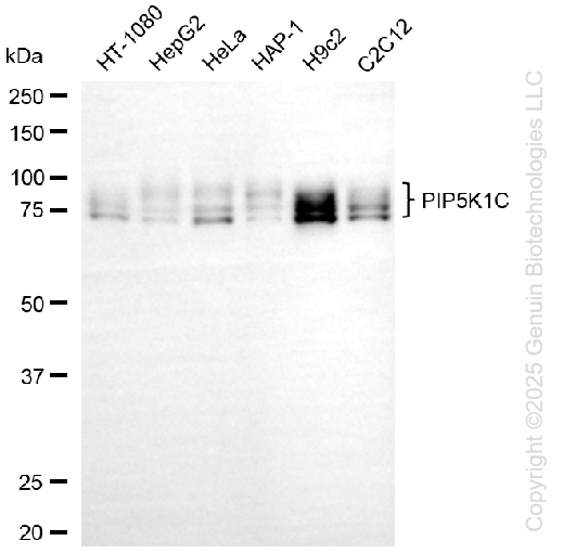 PIP5K1C antibody