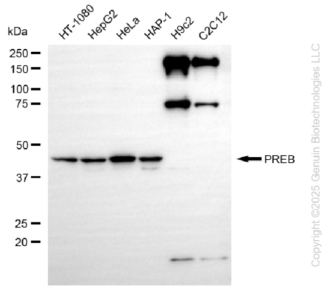 PREB antibody