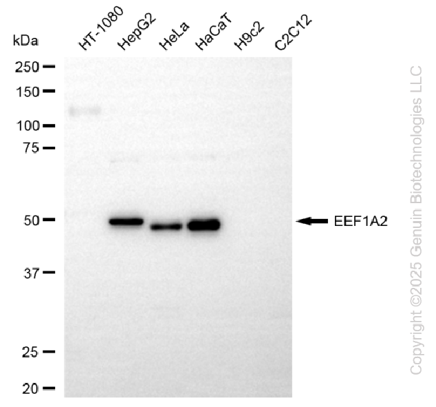 EEF1A2 antibody