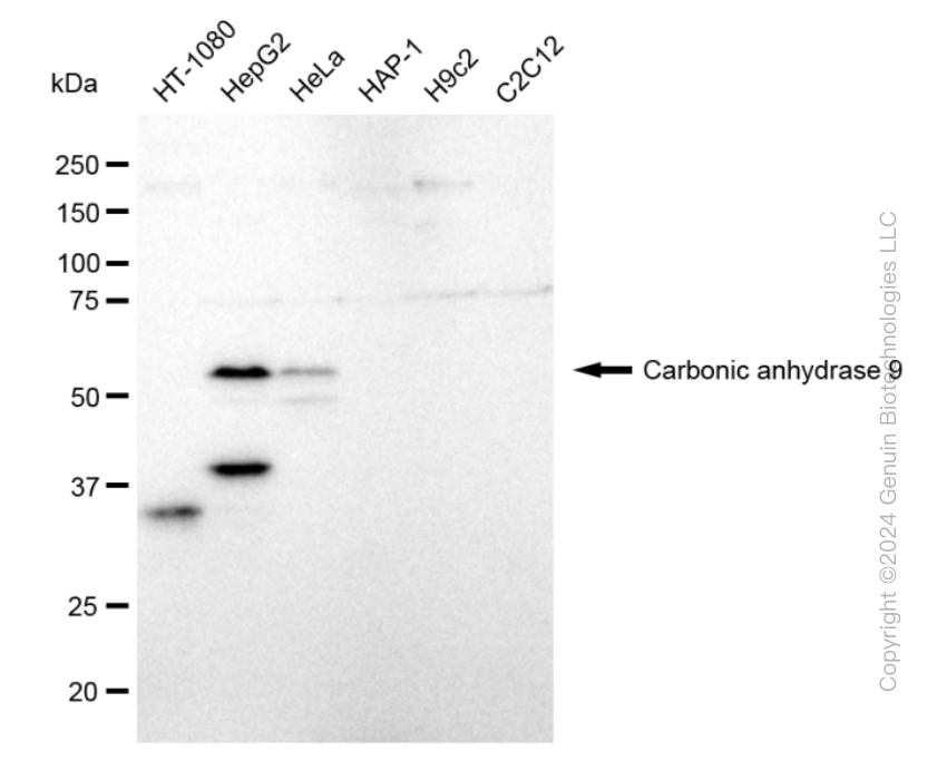 CA9 antibody