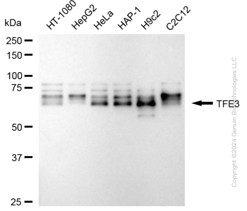 TFE3 antibody