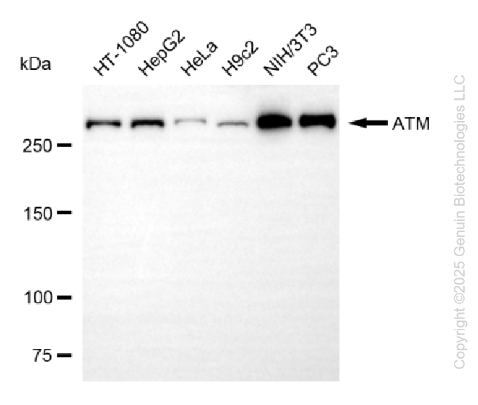 ATM antibody