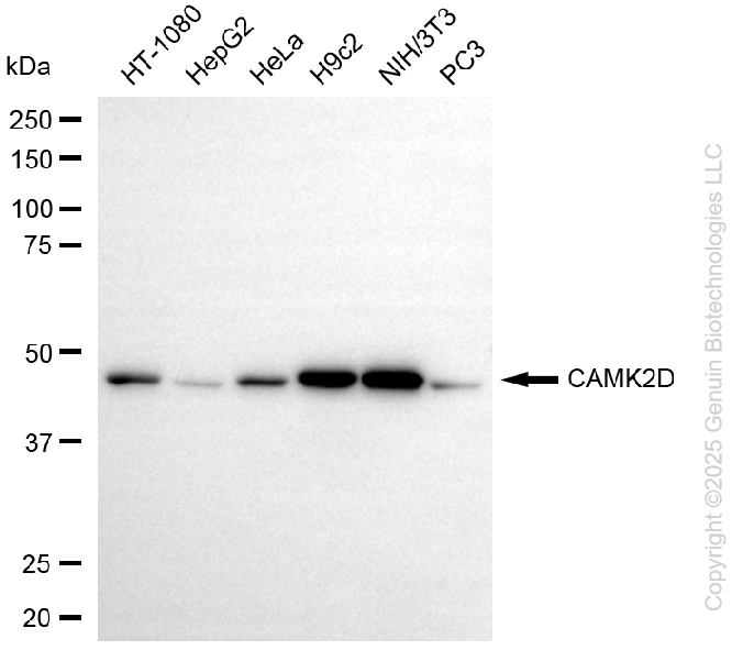 CAMK2D antibody
