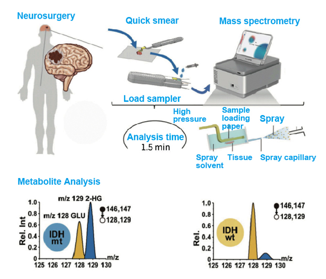 portable mass spectrometer