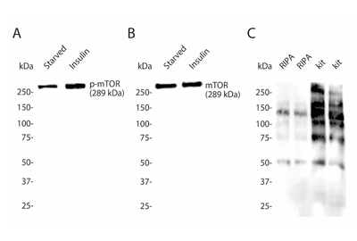 tissue lysis buffer