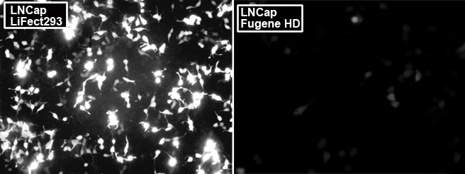 plasmid transfection