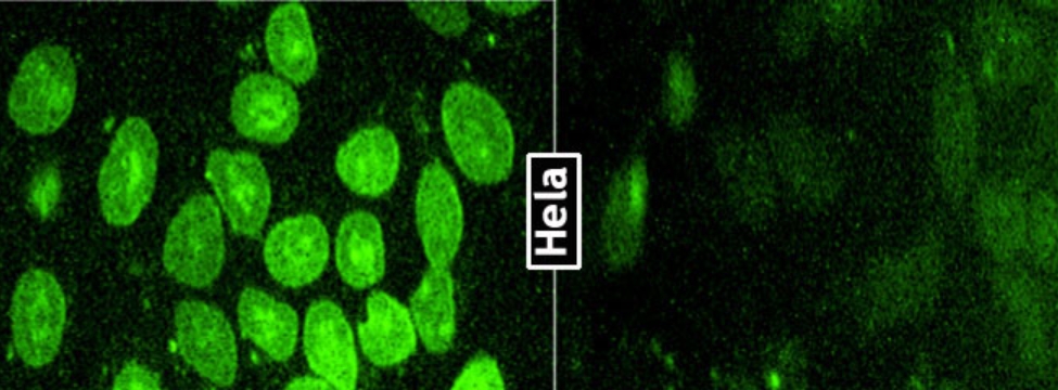 Hela cell Transfection