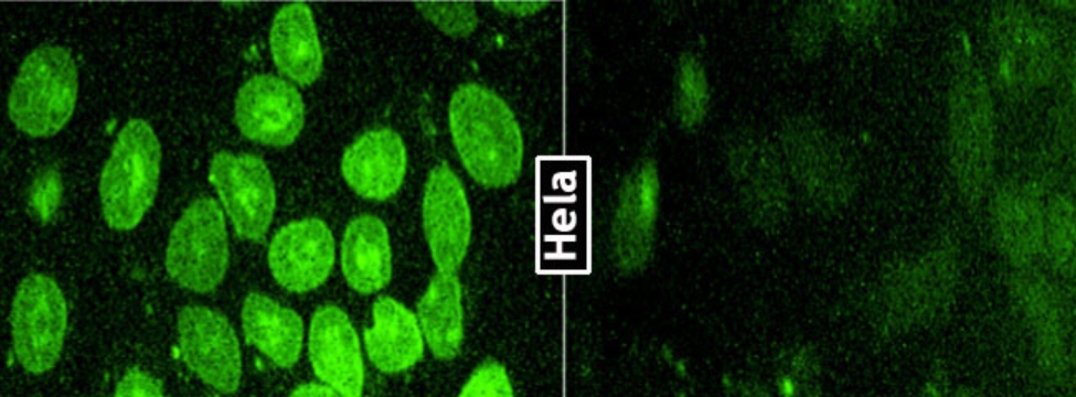 siRNA Transfection Reagent