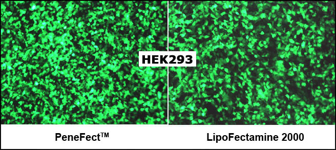 Transfection Reagent