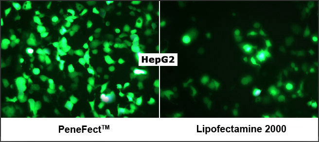 DNA Transfection Reagent
