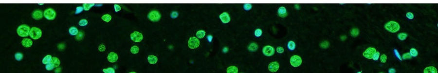 ROS Probes & Assay Kits